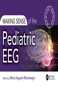 Making Sense of the Pediatric EEG_cover