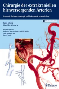 Chirurgie der extrakraniellen hirnversorgenden Arterien_cover