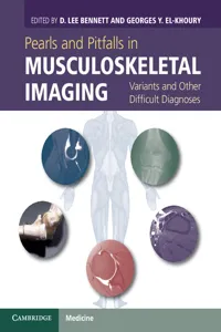 Pearls and Pitfalls in Musculoskeletal Imaging_cover