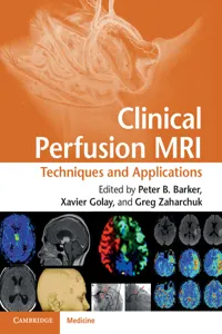 Clinical Perfusion MRI_cover