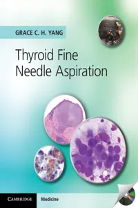 Thyroid Fine Needle Aspiration_cover