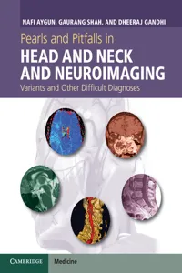 Pearls and Pitfalls in Head and Neck and Neuroimaging_cover