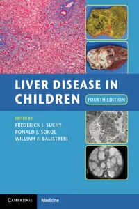 Liver Disease in Children_cover