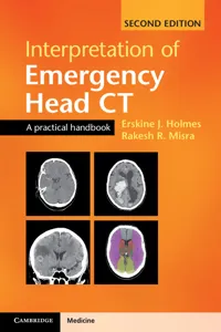 Interpretation of Emergency Head CT_cover