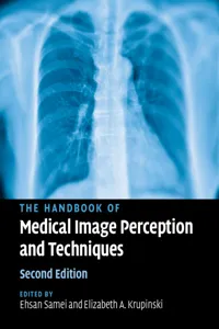The Handbook of Medical Image Perception and Techniques_cover