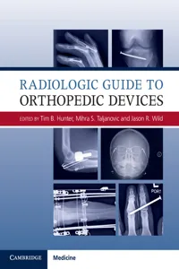 Radiologic Guide to Orthopedic Devices_cover