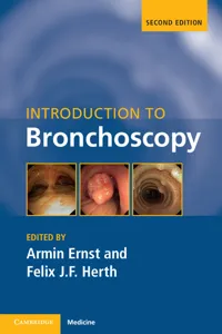 Introduction to Bronchoscopy_cover