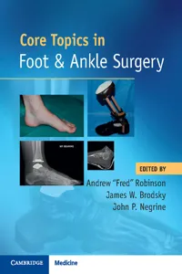 Core Topics in Foot and Ankle Surgery_cover