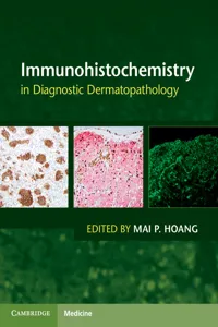 Immunohistochemistry in Diagnostic Dermatopathology_cover