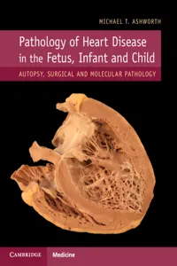 Pathology of Heart Disease in the Fetus, Infant and Child_cover