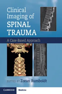 Clinical Imaging of Spinal Trauma_cover