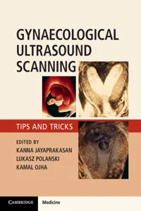 Gynaecological Ultrasound Scanning_cover