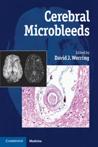 Cerebral Microbleeds_cover