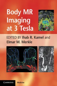 Body MR Imaging at 3 Tesla_cover