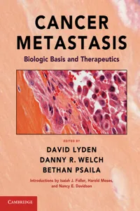 Cancer Metastasis_cover