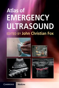 Atlas of Emergency Ultrasound_cover