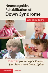 Neurocognitive Rehabilitation of Down Syndrome_cover