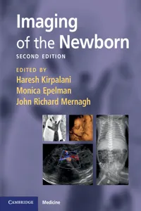 Imaging of the Newborn_cover