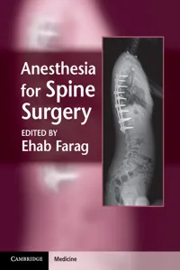 Anesthesia for Spine Surgery_cover