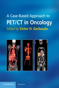 A Case-Based Approach to PET/CT in Oncology_cover