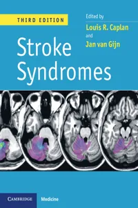 Stroke Syndromes, 3ed_cover