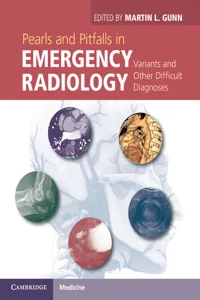 Pearls and Pitfalls in Emergency Radiology_cover