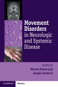 Movement Disorders in Neurologic and Systemic Disease_cover