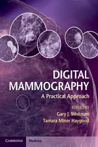 Digital Mammography_cover