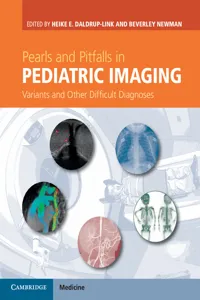 Pearls and Pitfalls in Pediatric Imaging_cover