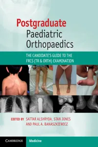 Postgraduate Paediatric Orthopaedics_cover