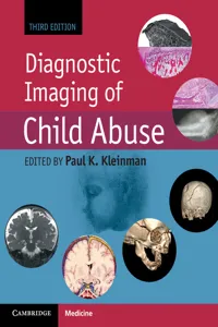 Diagnostic Imaging of Child Abuse_cover