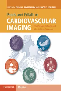 Pearls and Pitfalls in Cardiovascular Imaging_cover