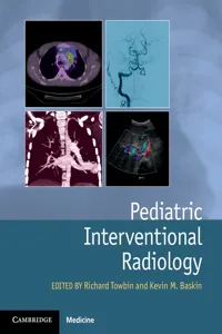 Pediatric Interventional Radiology_cover