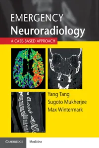 Emergency Neuroradiology_cover