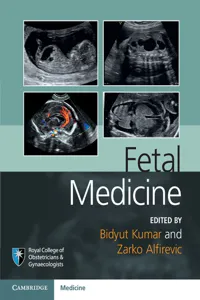 Fetal Medicine_cover