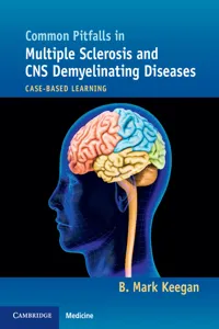 Common Pitfalls in Multiple Sclerosis and CNS Demyelinating Diseases_cover