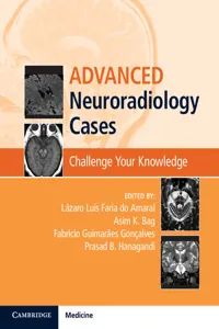 Advanced Neuroradiology Cases_cover