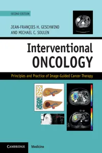 Interventional Oncology_cover