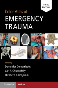 Color Atlas of Emergency Trauma_cover