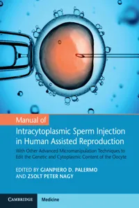 Manual of Intracytoplasmic Sperm Injection in Human Assisted Reproduction_cover