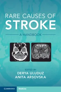 Rare Causes of Stroke_cover