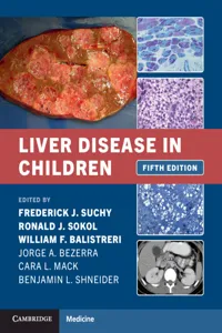 Liver Disease in Children_cover