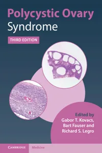 Polycystic Ovary Syndrome_cover
