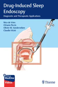 Drug-Induced Sleep Endoscopy_cover