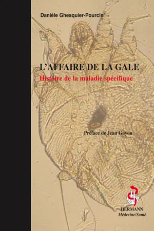 L'affaire de la gale