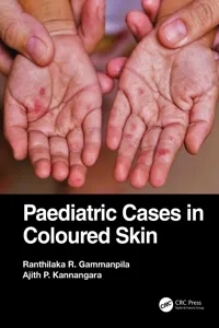 Paediatric Cases in Coloured Skin_cover