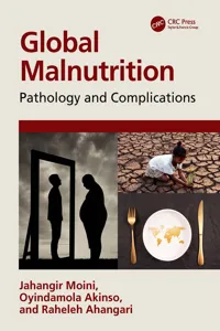 Global Malnutrition_cover
