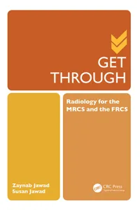 Get Through Radiology for the MRCS and the FRCS_cover