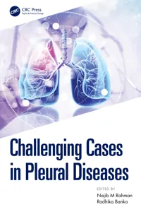 Challenging Cases in Pleural Diseases_cover