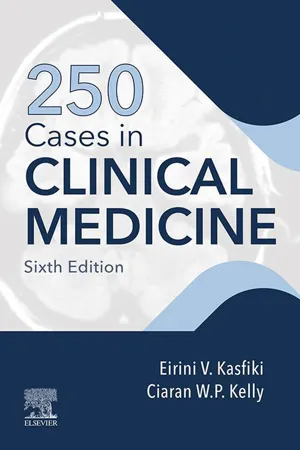 250 Cases in Clinical Medicine E-Book